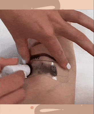 Image Title My Image